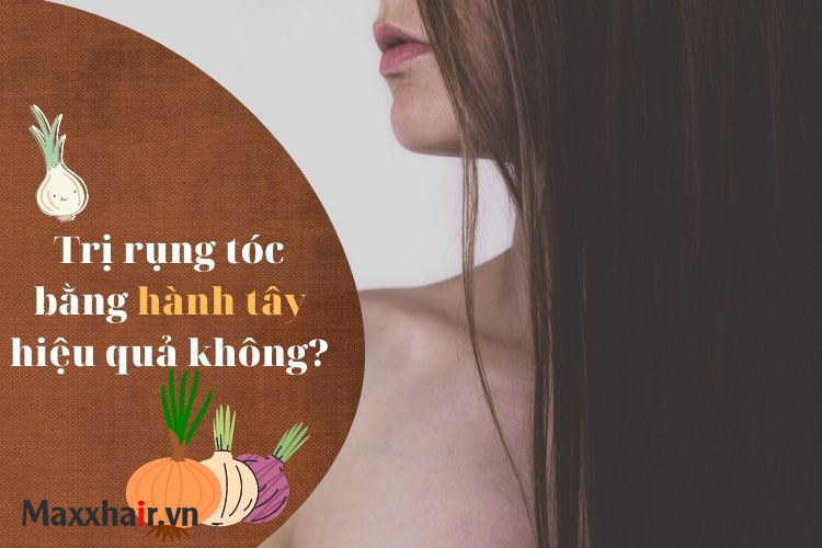 Trị rụng tóc bằng hành tây hiệu quả cực kì bất ngờ