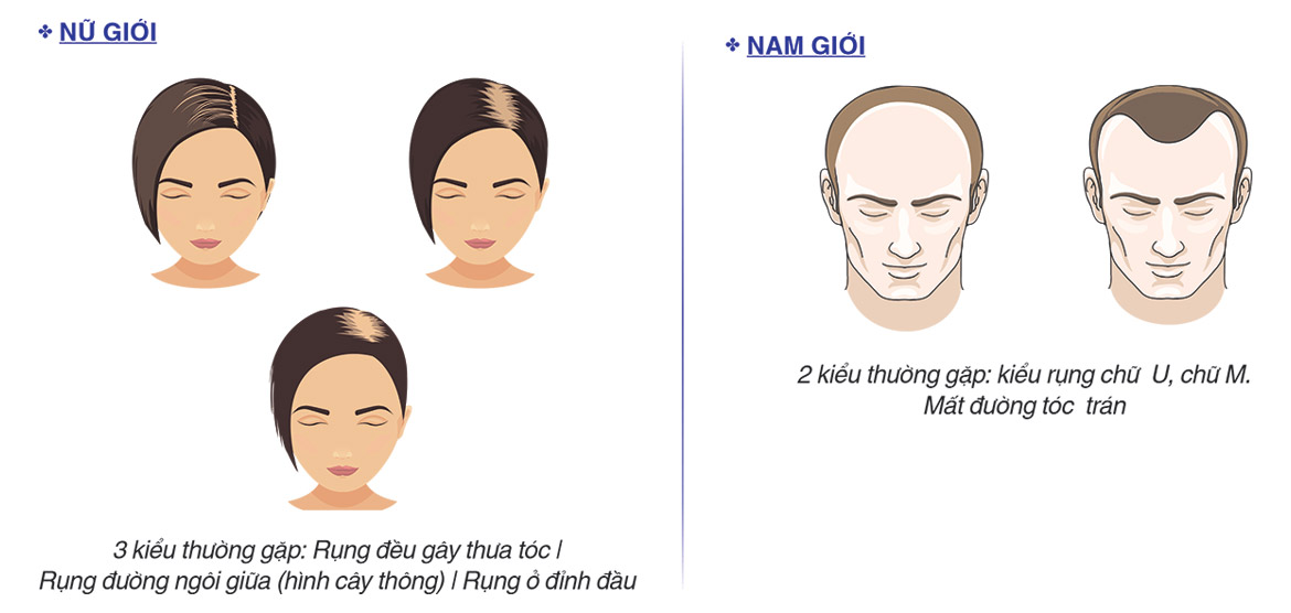 Tóc rụng nhiều 