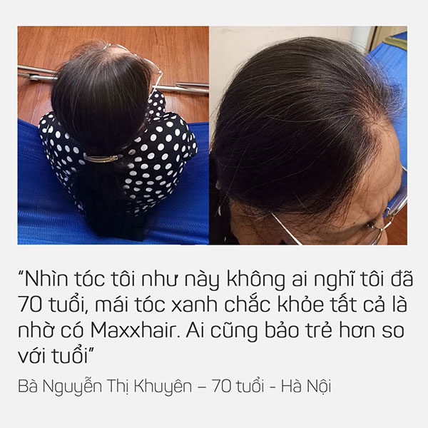 Khách hàng nói gì về Maxxhair? 1