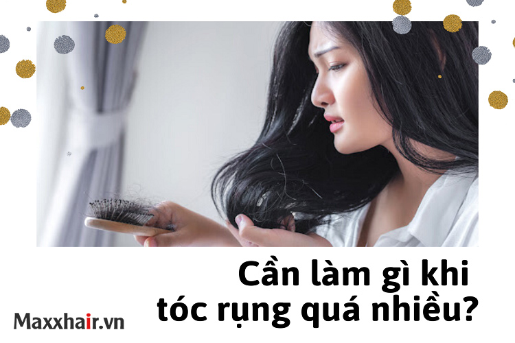 Cần làm gì khi tóc rụng quá nhiều? 1