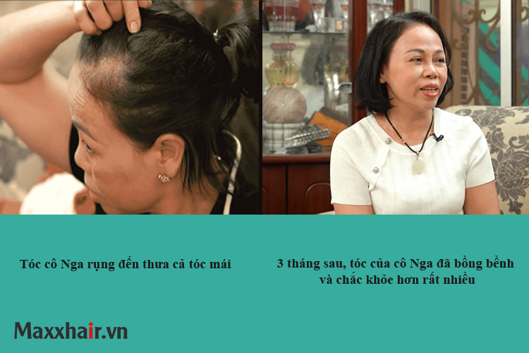 Người dùng phản hồi về Maxxhair ra sao? 1