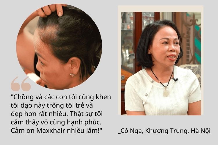 Viên uống Maxxhair - Giải pháp cải thiện hói đầu từ bên trong 4