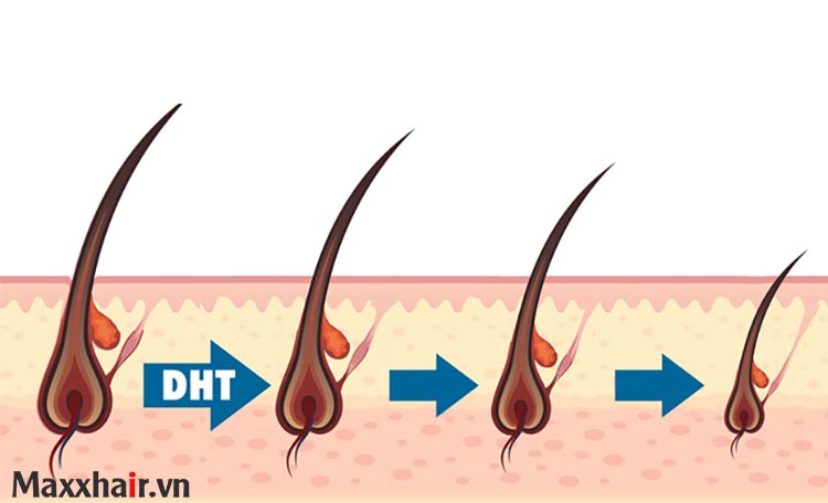 Mất cân bằng hormone 1