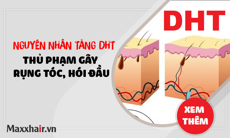 Nguyên nhân tăng DHT -  Thủ phạm gây ra rụng tóc, hói đầu