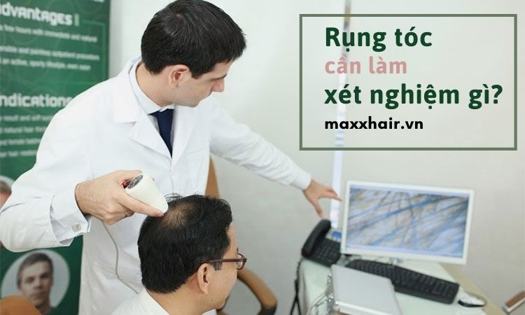 Rụng tóc cần làm xét nghiệm gì?