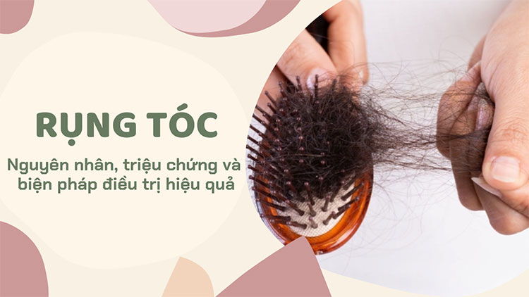 Đi tìm nguyên nhân và các biện pháp điều trị bệnh rụng tóc