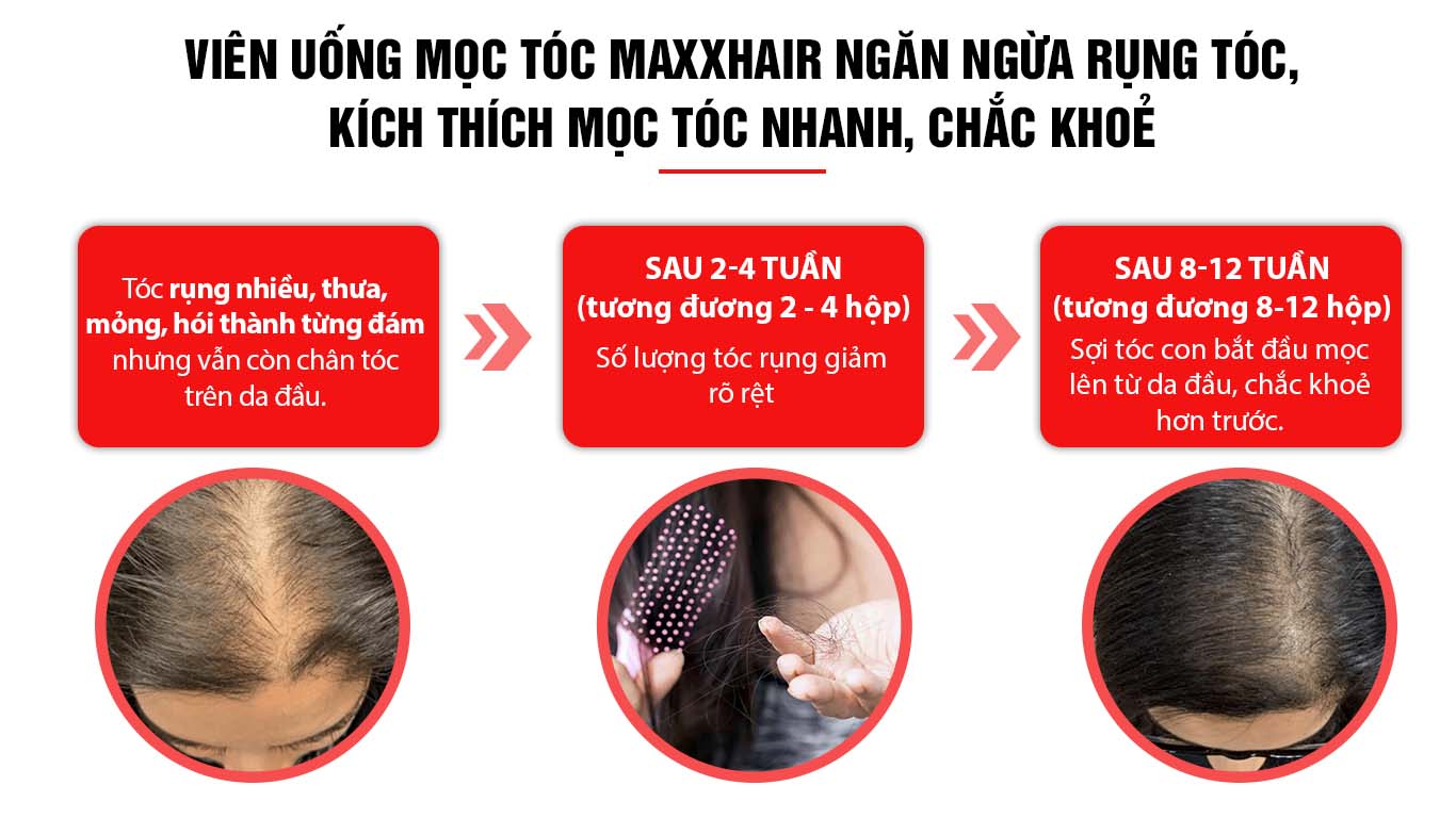 Liệu trình sử dụng Maxxhair hiệu quả 1