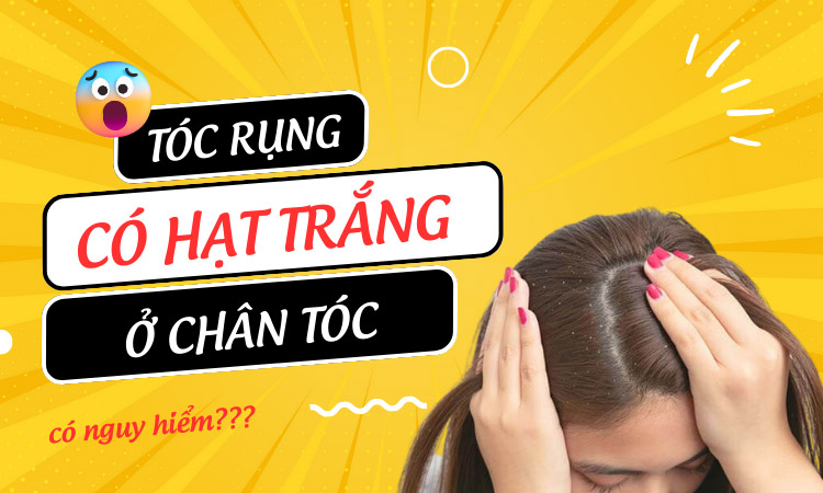 Tóc rụng có hạt trắng ở chân tóc là bệnh gì? Có nguy hiểm không?