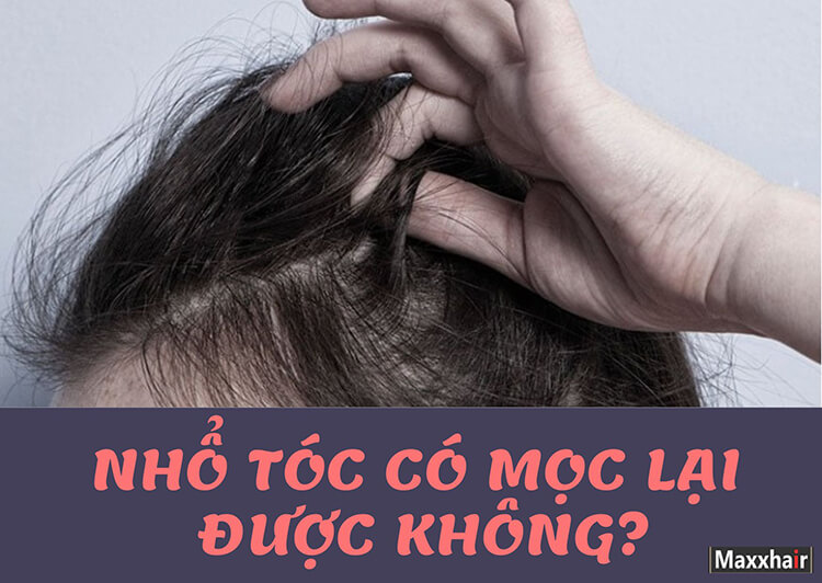 [XEM NGAY] Nhổ tóc có mọc lại được không?