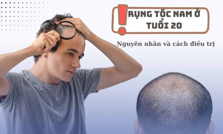 Lo lắng khi bị rụng tóc ở nam tuổi 20: Nguyên nhân do đâu và điều trị thế nào?