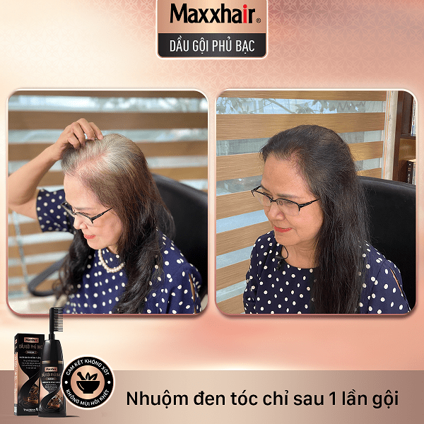 Khách hàng đã gội nhuộm đen tóc từ Dầu gội phủ bạc Maxxhair 3