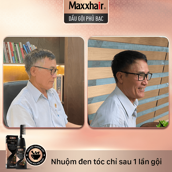 Khách hàng đã gội nhuộm đen tóc từ Dầu gội phủ bạc Maxxhair 2