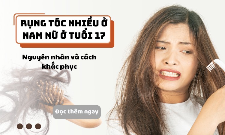 Rụng tóc nhiều ở nam nữ tuổi 17 có sao không? Cách khắc phục hiệu quả 