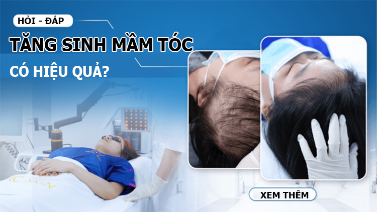 Tăng sinh mầm tóc có hiệu quả không?