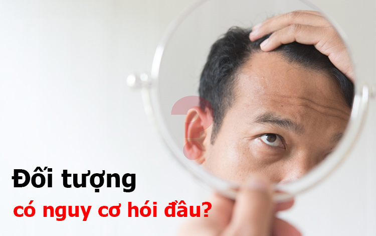 Ai có nguy cơ hói đầu cao?